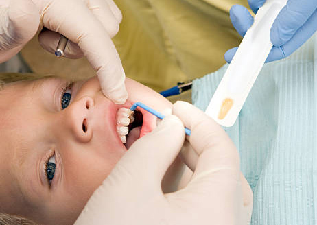 Teeth cleaning: Fluordie Treatment Banner