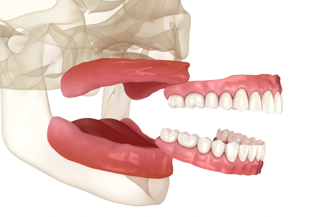 Complete Dentures Banner