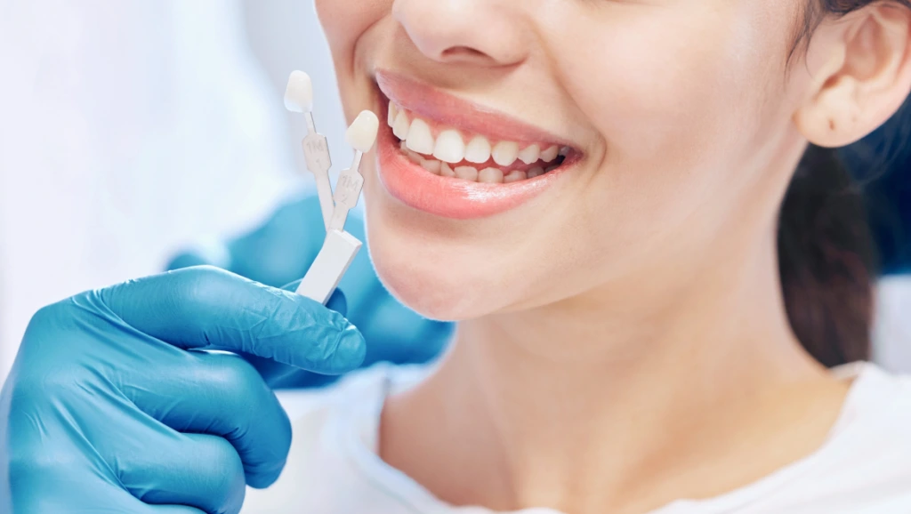 Porcelain Veneers banner