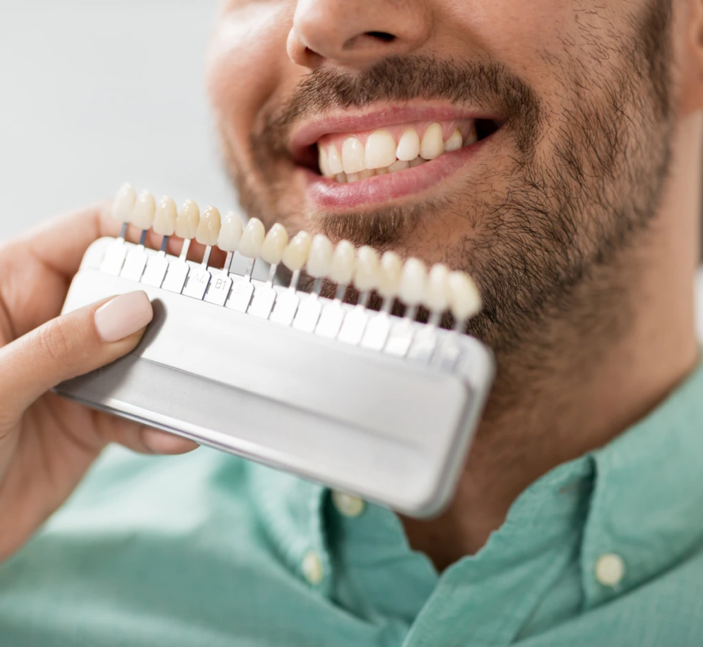 Veneers Placement Procedure Banner