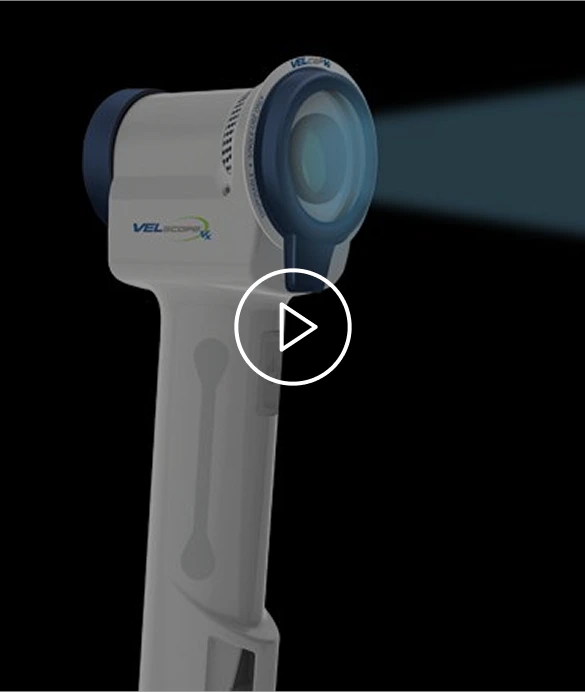 Oral Cancer Screening in Indianapolis, IL: Video Thumbnail
