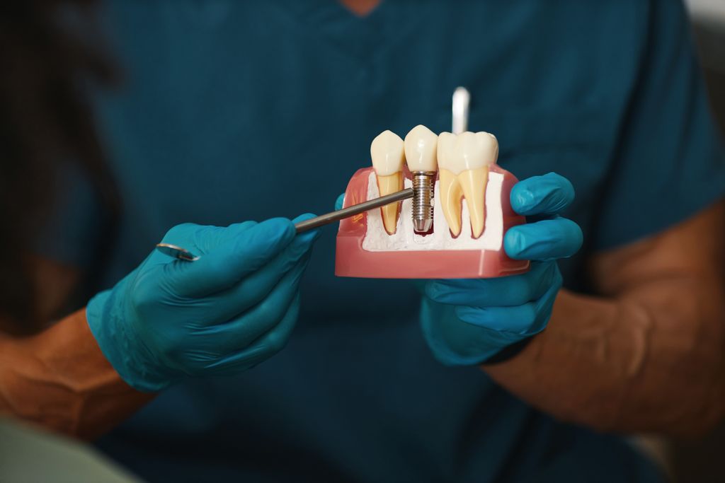 What Are the 3 Types of Dental Implants? Banner