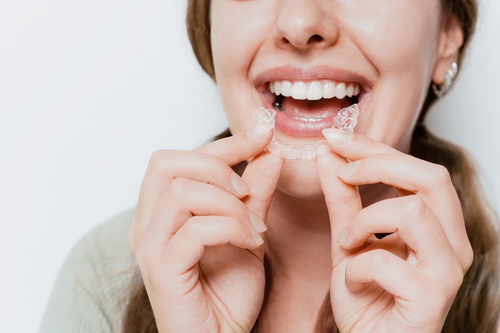 How Long Does Invisalign Take? Banner